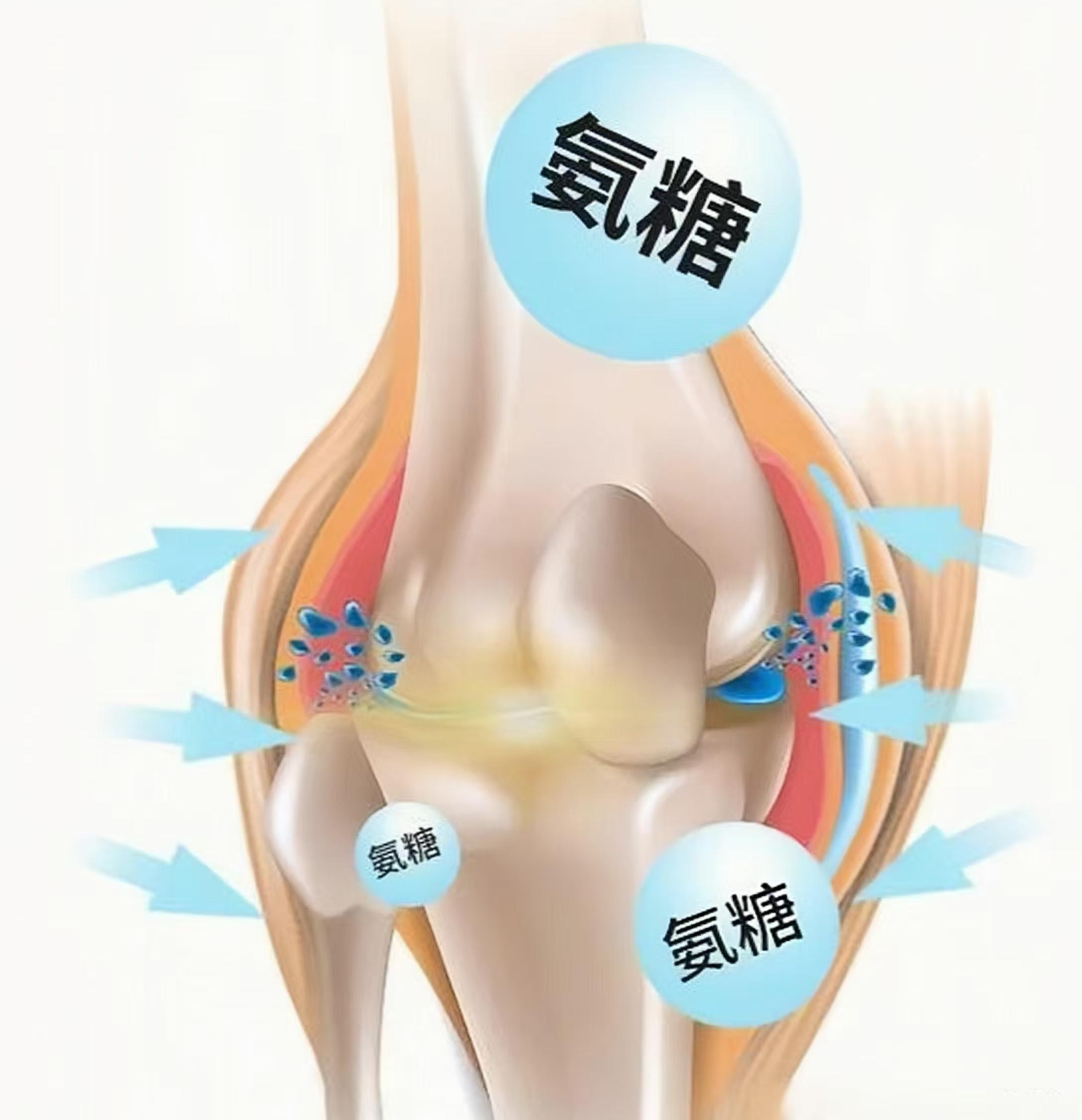 氨糖適合什么樣的人群補(bǔ)充？